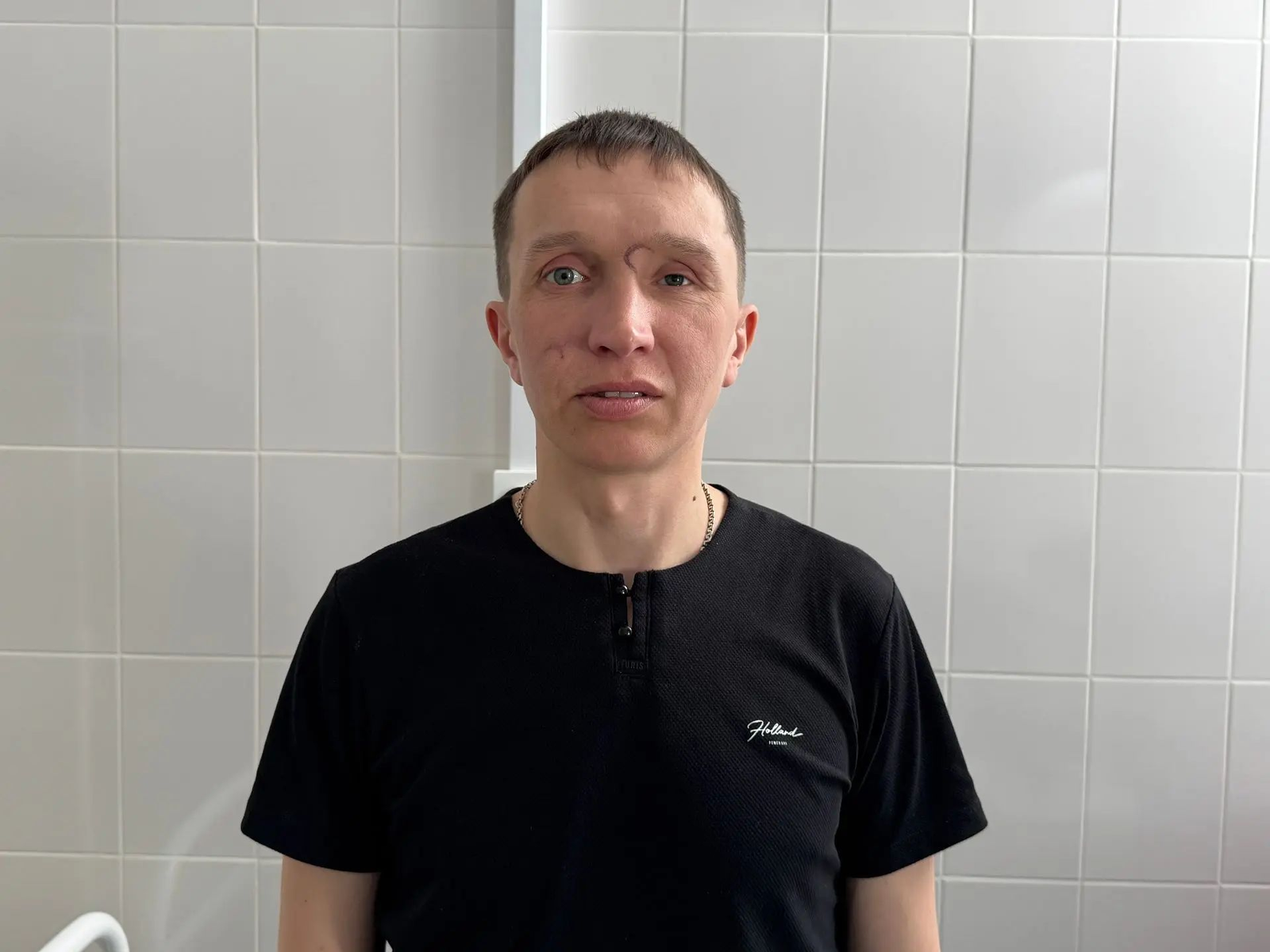 В Башкортостане ветерану СВО провели цикл пластических операций