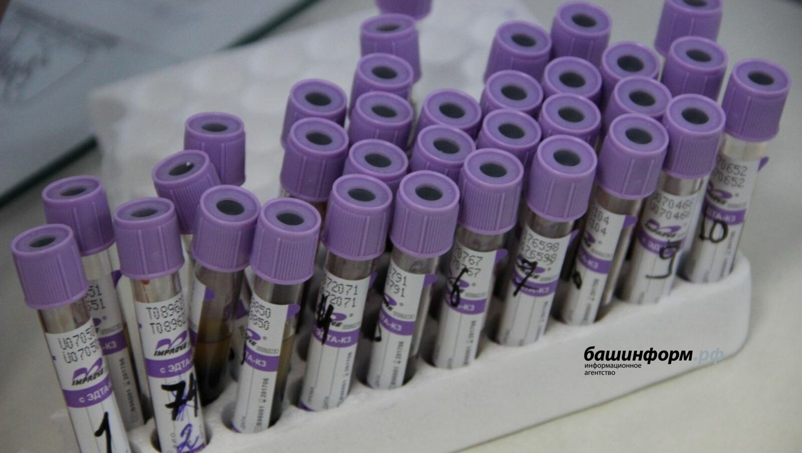 Жители Башкирии могут стать донорами костного мозга