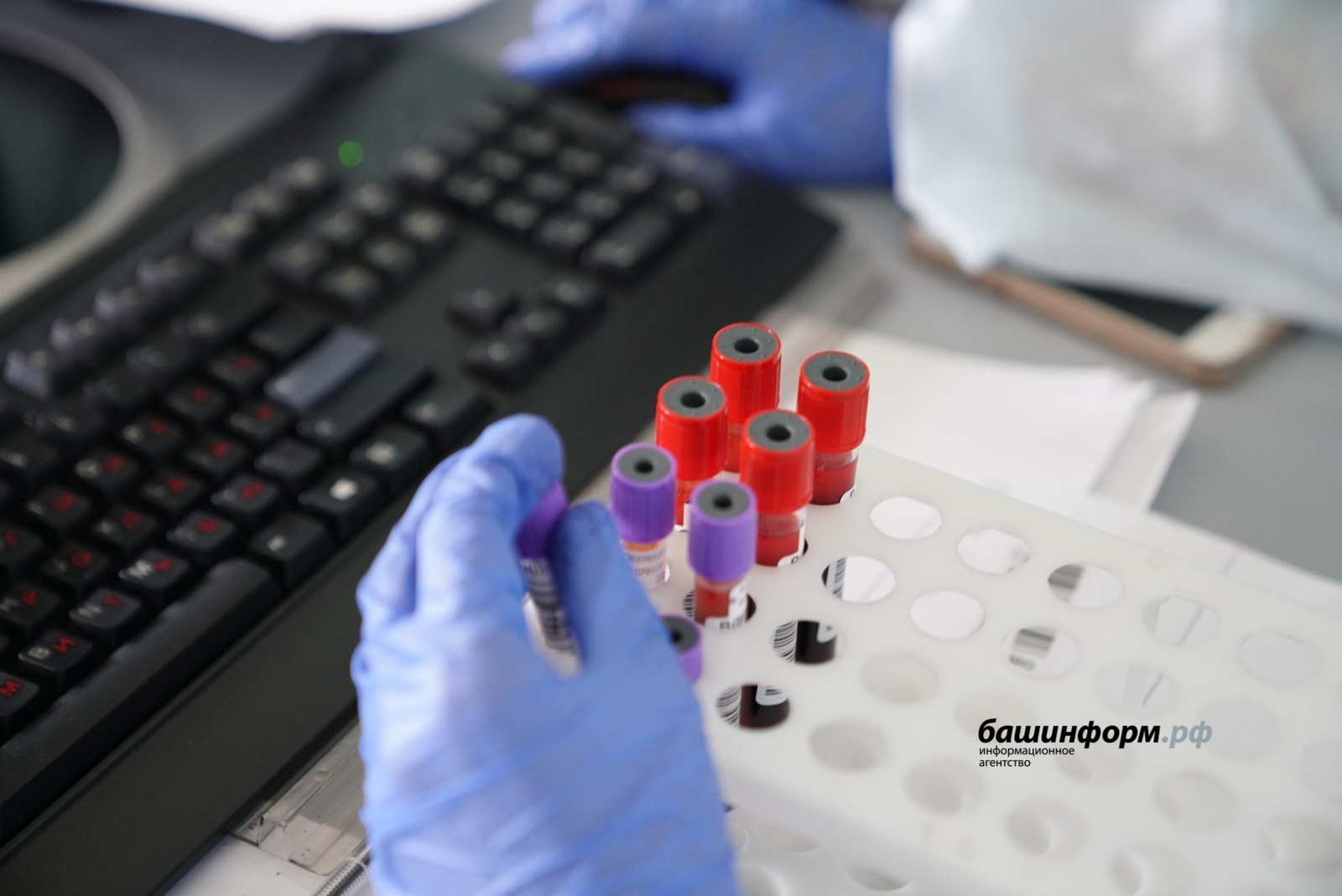 В Роспотребнадзоре Башкирии напомнили, как защититься от бешенства